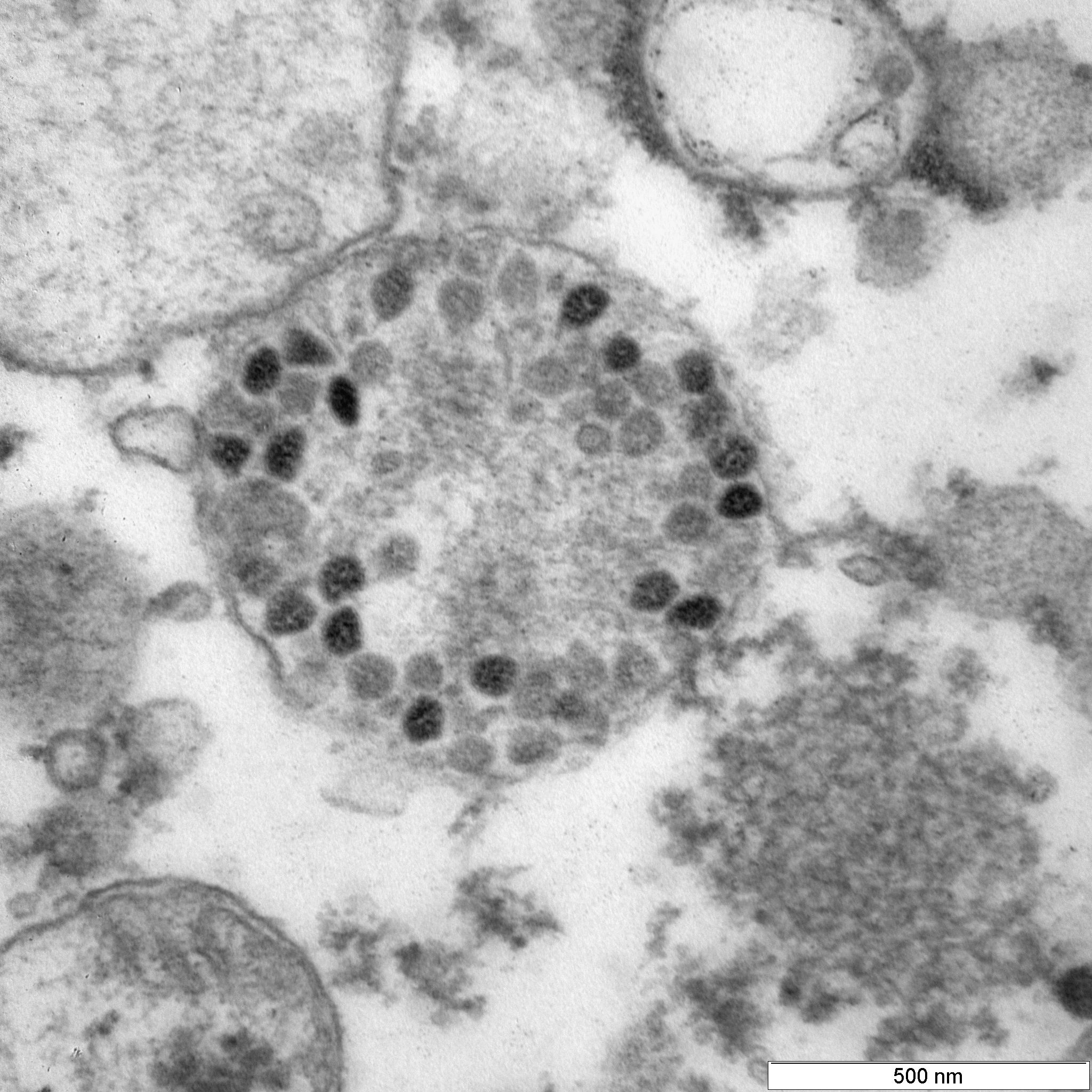 Коронавирус штаммы омикрон. Вирус Covid 19 под микроскопом. Штаммы коронавируса под микроскопом. Омикрон штамм коронавируса. Дельта штамм коронавируса под микроскопом.
